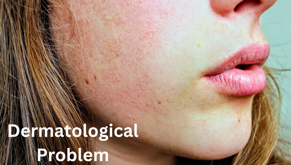 Dermatological Problem